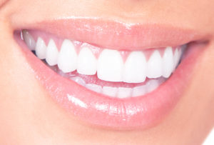 Mondhygiene-vrouw-met-lach-witte-tanden - Tandaanslag verwijderen in Utrecht