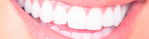Mondhygiene-vrouw-met-lach-witte-tanden-behandelingen-utrecht-overvecht-tandarts