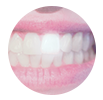 facings-tandarts-mondzorgpraktij-orion-utrecht-overvecht-witte-tanden-cosmetische-tandheelkunde-estetische-tandheelkunde-facings-icon-2