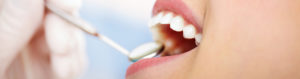 mondzorgpraktijk-utrecht-overvecht-amsterdam-leeuwarden-behandelingen-controle-tandarts-mooie-tanden-witte-spoed-schone-goedkoop